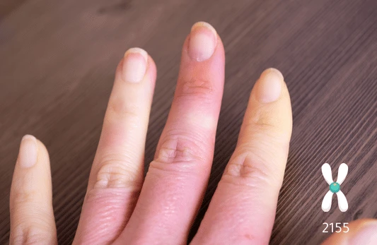 مضاد السنترومير