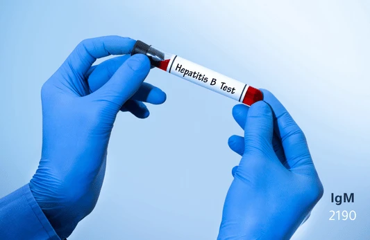 الأجسام المضادة IgM لبروتين التهاب الكبد ب (HBe)