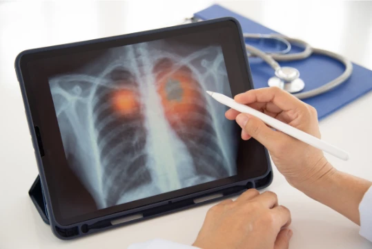 تصوير الأشعة في المنزل