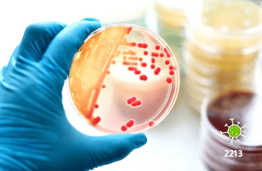 مسحة النيسرية البنية