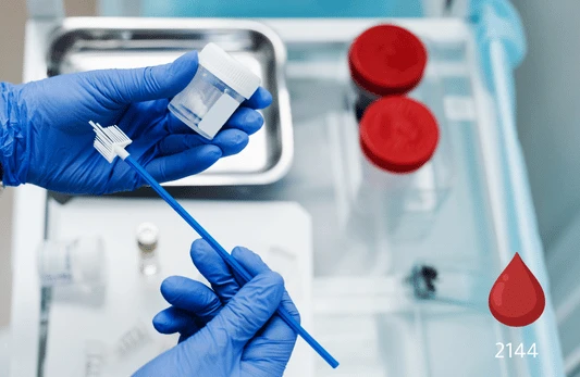 مسحة الدم المحيطي