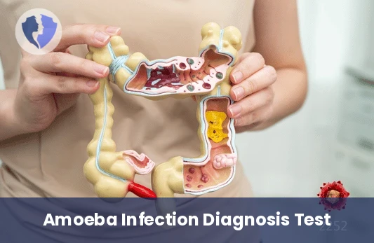 Amoebiasis Serology Test