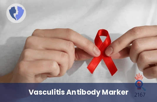 Anti-Myeloperoxidase (MPO) Antibodies Test