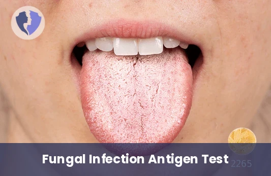 Candida Soluble Antigen Test