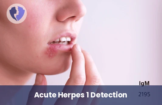 Herpes Simplex Virus 1 (HSV-1) IgM Test