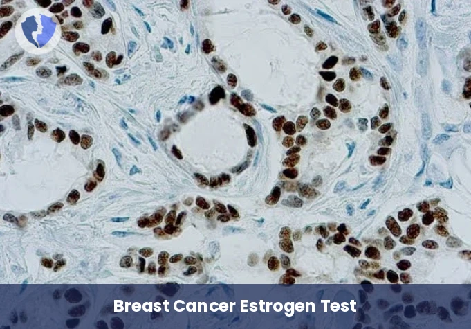 Immunohistochemistry: Estrogen Receptor (ER)