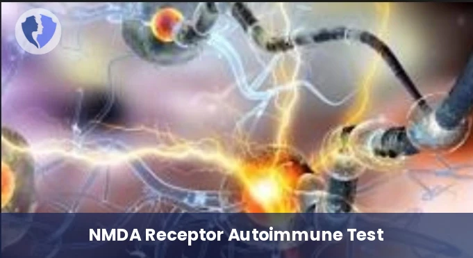 NMDA Receptor Antibody Test