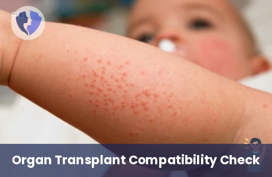 Panel Reactive Antibodies (PRA) Test