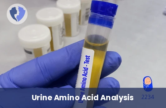 Quantitative Urine Amino Acids Test