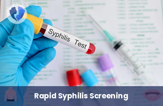 VDRL Syphilis Test