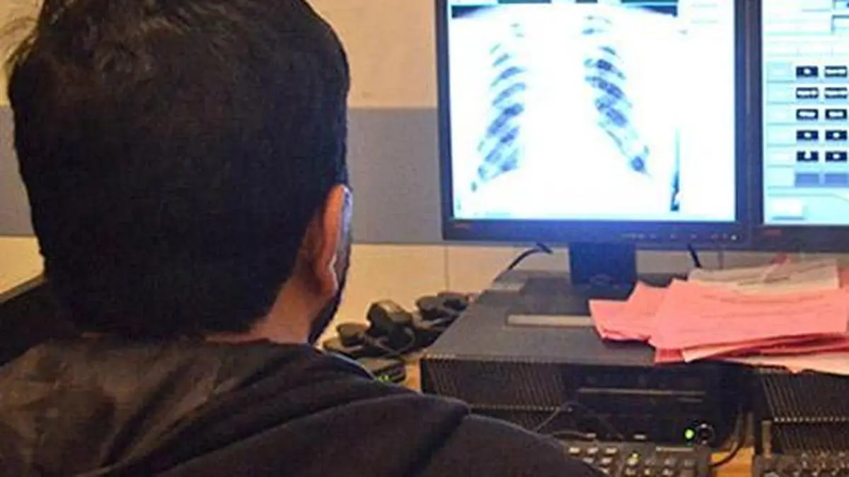 IIIT-H Study Warns Against Full Reliance on AI for Medical Diagnosis