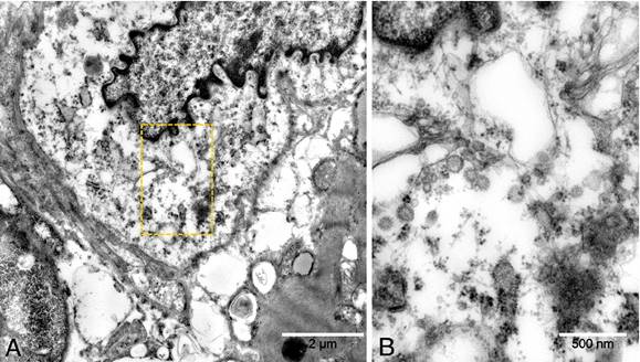 https://onlinelibrary.wiley.com/cms/asset/1b6c584a-a1f3-4da0-8fe6-8551d75438c1/ejhf1828-fig-0003-m.jpg