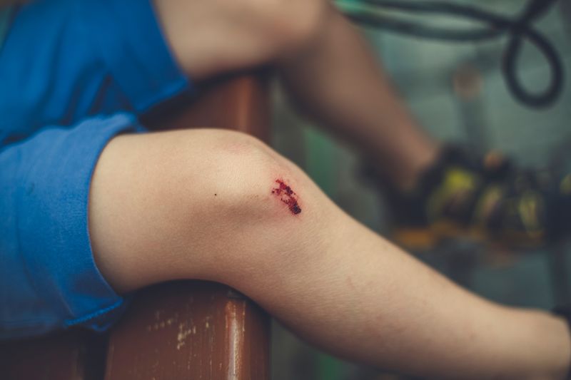 A child's scraped knee.