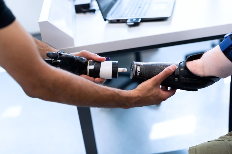 A prosthetist fitting a prosthetic are to an amputee