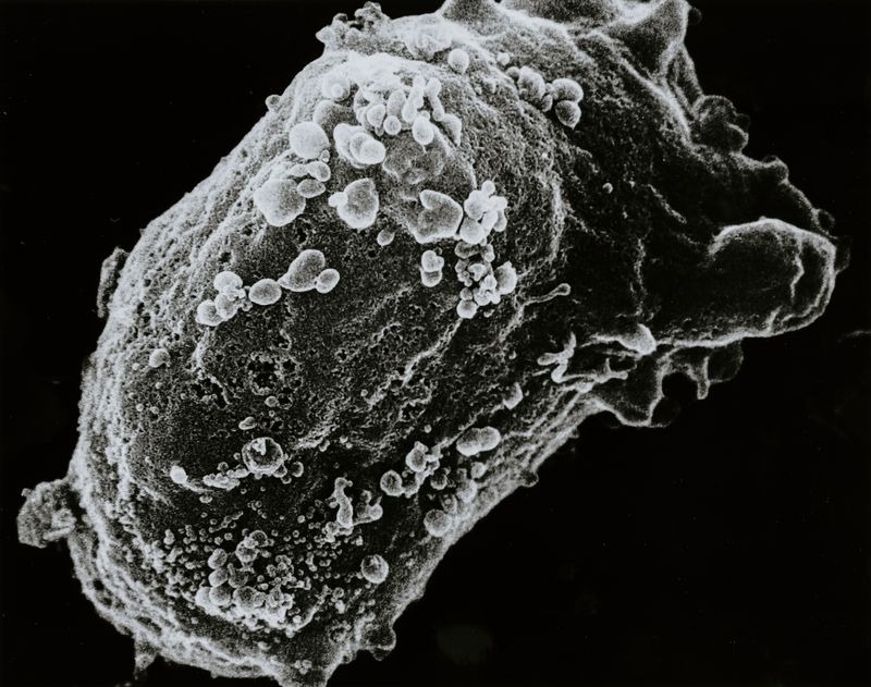 A black and white diagnostic image showing an STD virus.