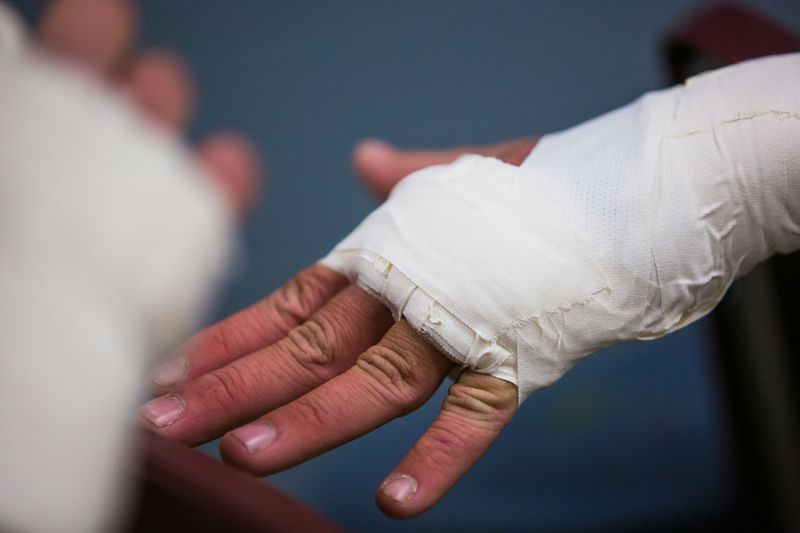 A hand and wrist in a medical cast.
