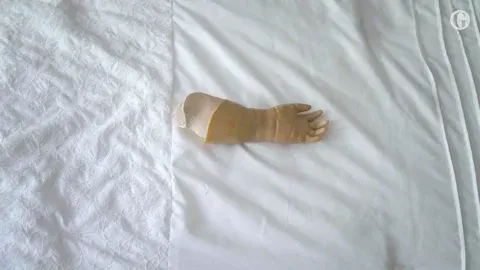 A left hand prosthesis being built.