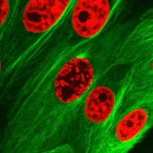 GIF animation image that shows 3D cell division of cells with confocal microscopy. Chromosomes are red and protein is green.