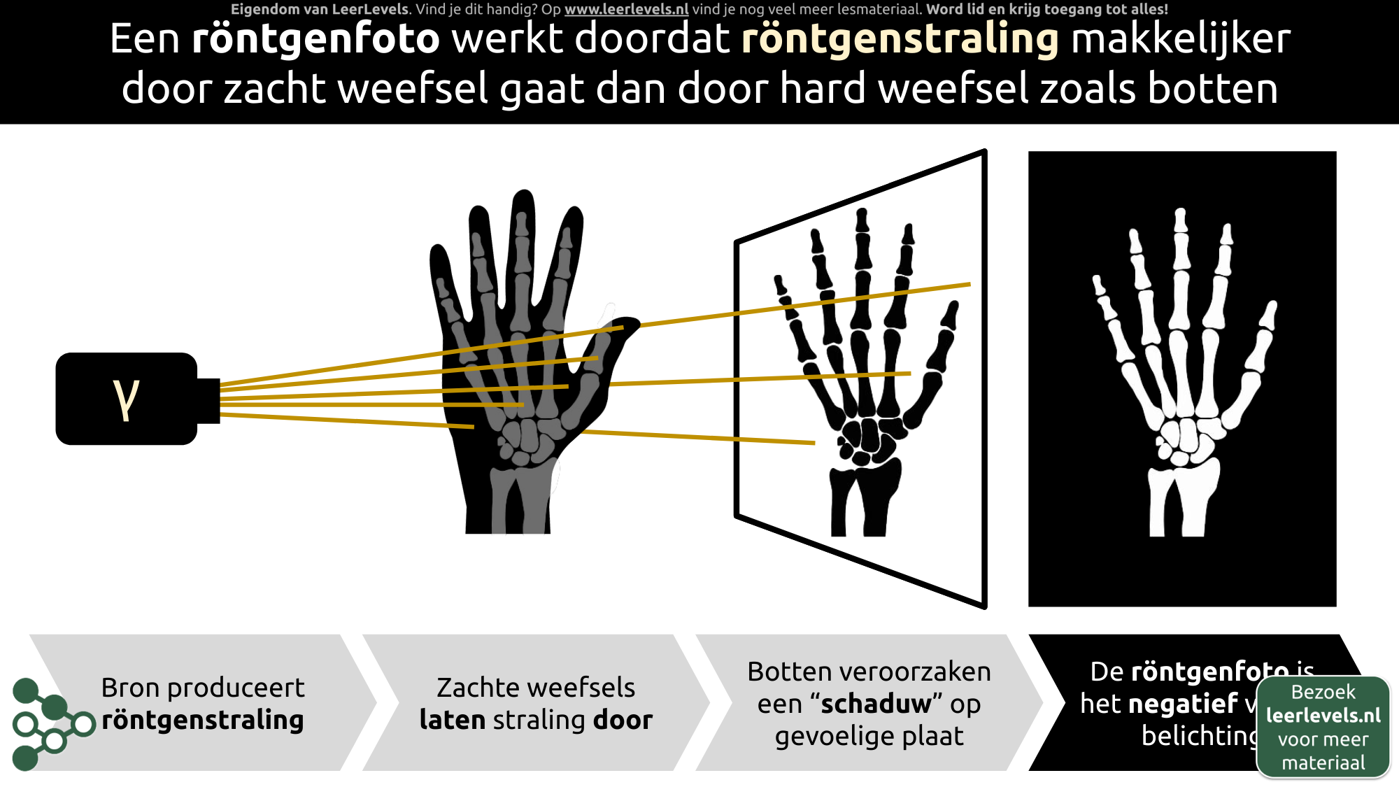 Afbeelding voor Röntgenfoto