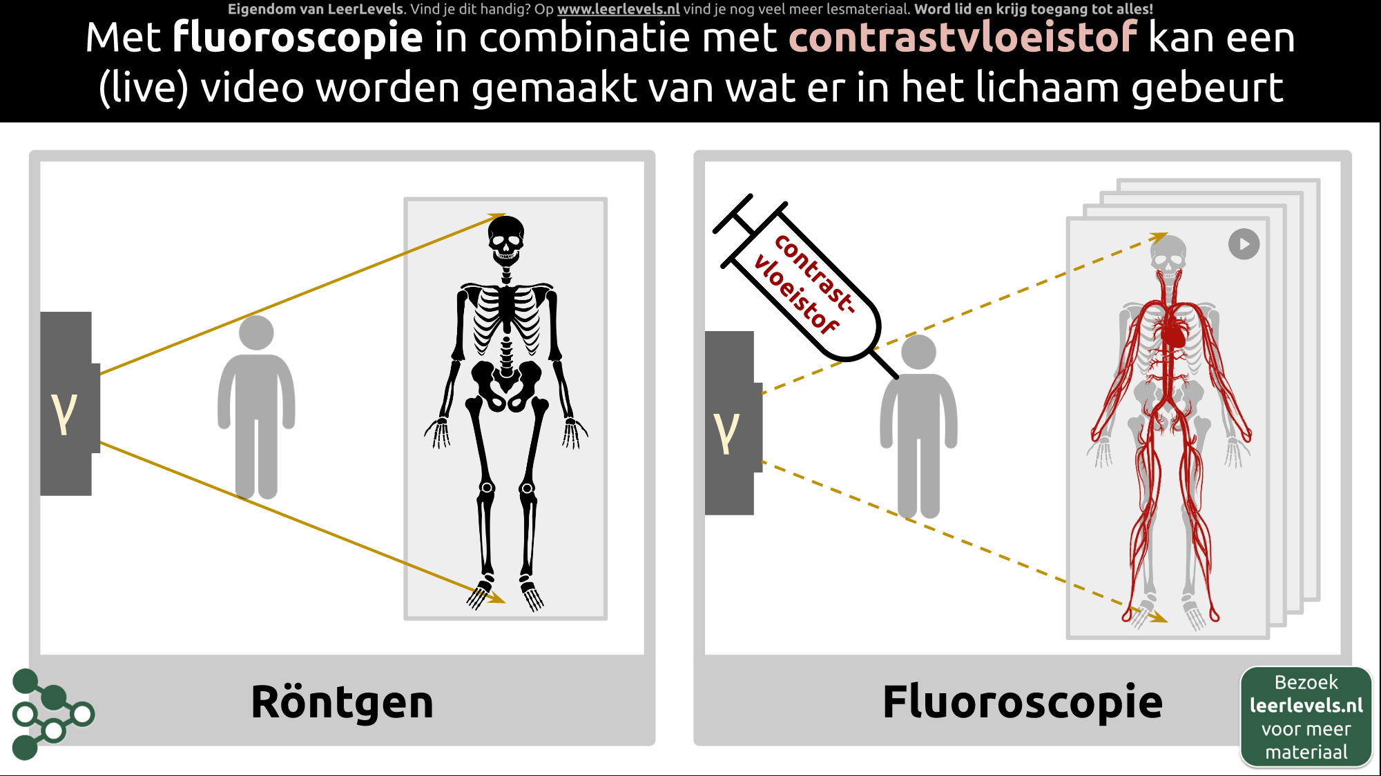 Afbeelding voor Fluoroscopie