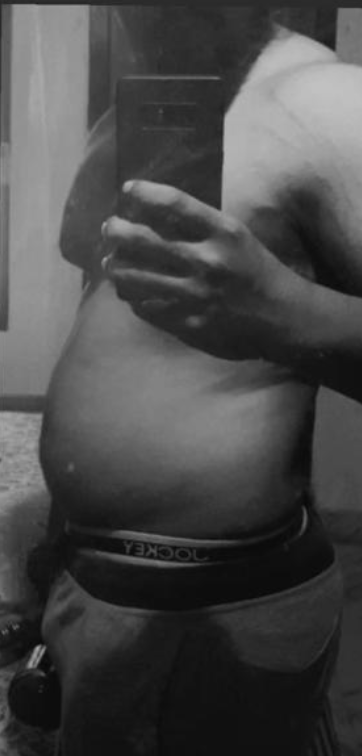 Before transformation