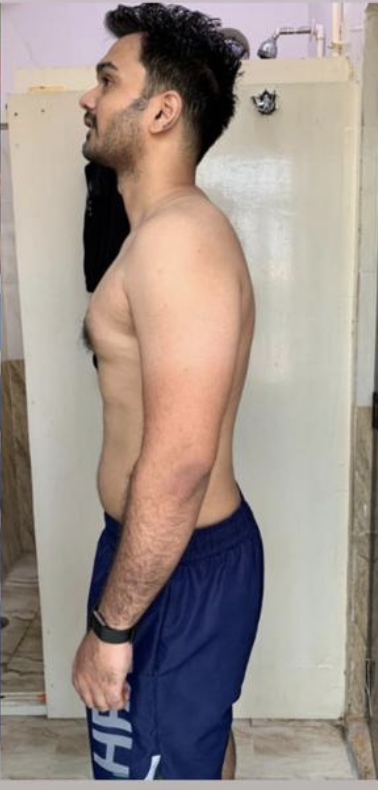 After transformation