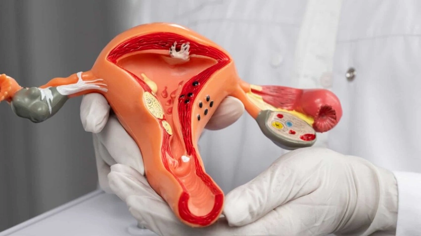 El Incart reportó 110 nuevos casos de cáncer de cérvix en 2025; especialistas advierten baja edad de inicio