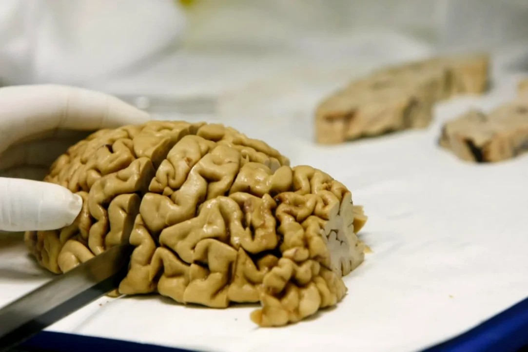 La neurología aboga por pausas laborales mínimas de 10 días para reducir la saturación mental y activar la neuroplasticidad