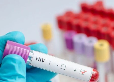 Modelo de atención integral reduce 74 % la mortalidad de personas con VIH en RD