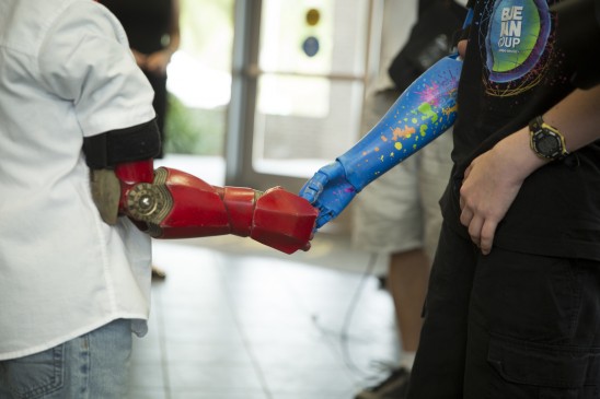 Bionic kids Alex and Wyatt shaking hands