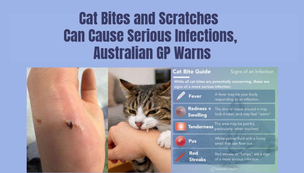 Cat Bites and Scratches Can Cause Serious Infections, Australian GP Warns