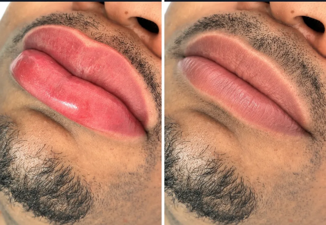 Micropigmentacion de labios: trabajo 3