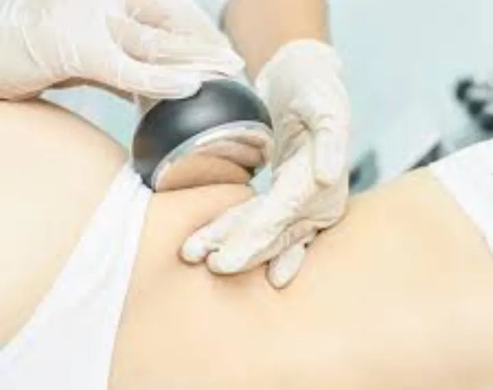 Tratamiento de cavitación corporal+presoterapia