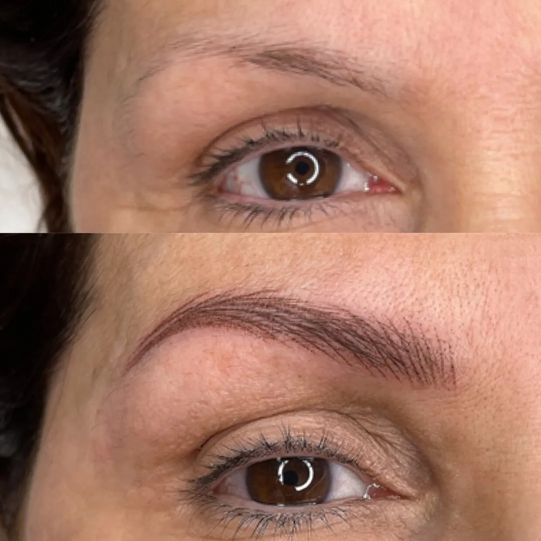 DERMOPIGMENTACION FACIAL: trabajo 2