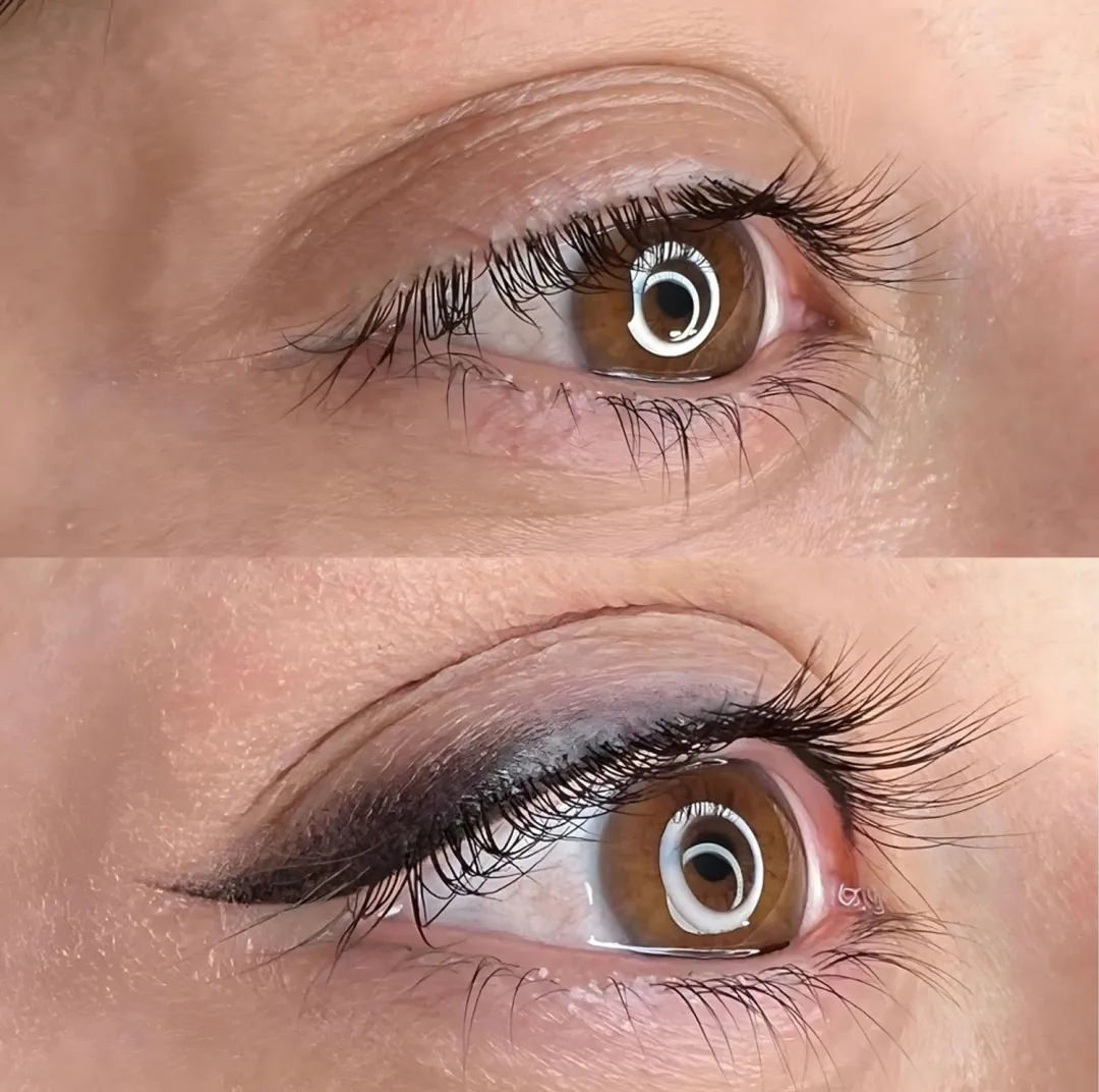 DERMOPIGMENTACION FACIAL: trabajo 3