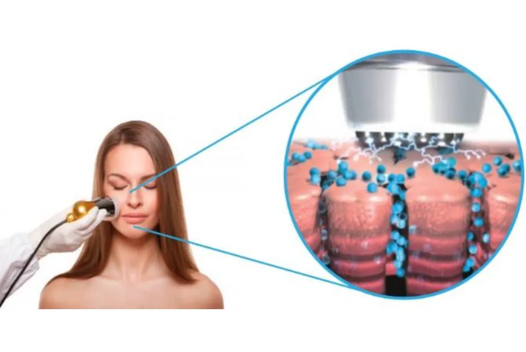 Mesoterapia Virtual