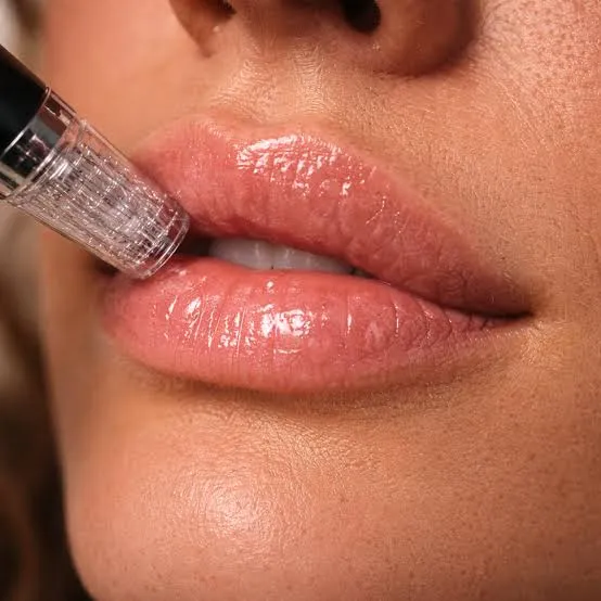 MICROMESOTERAPIA HIDRALIPS