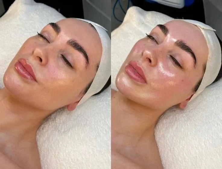 TRATAMIENTO FACIAL PERSONALIZADO