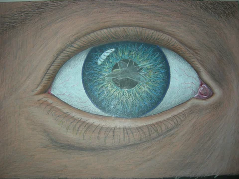 Eye