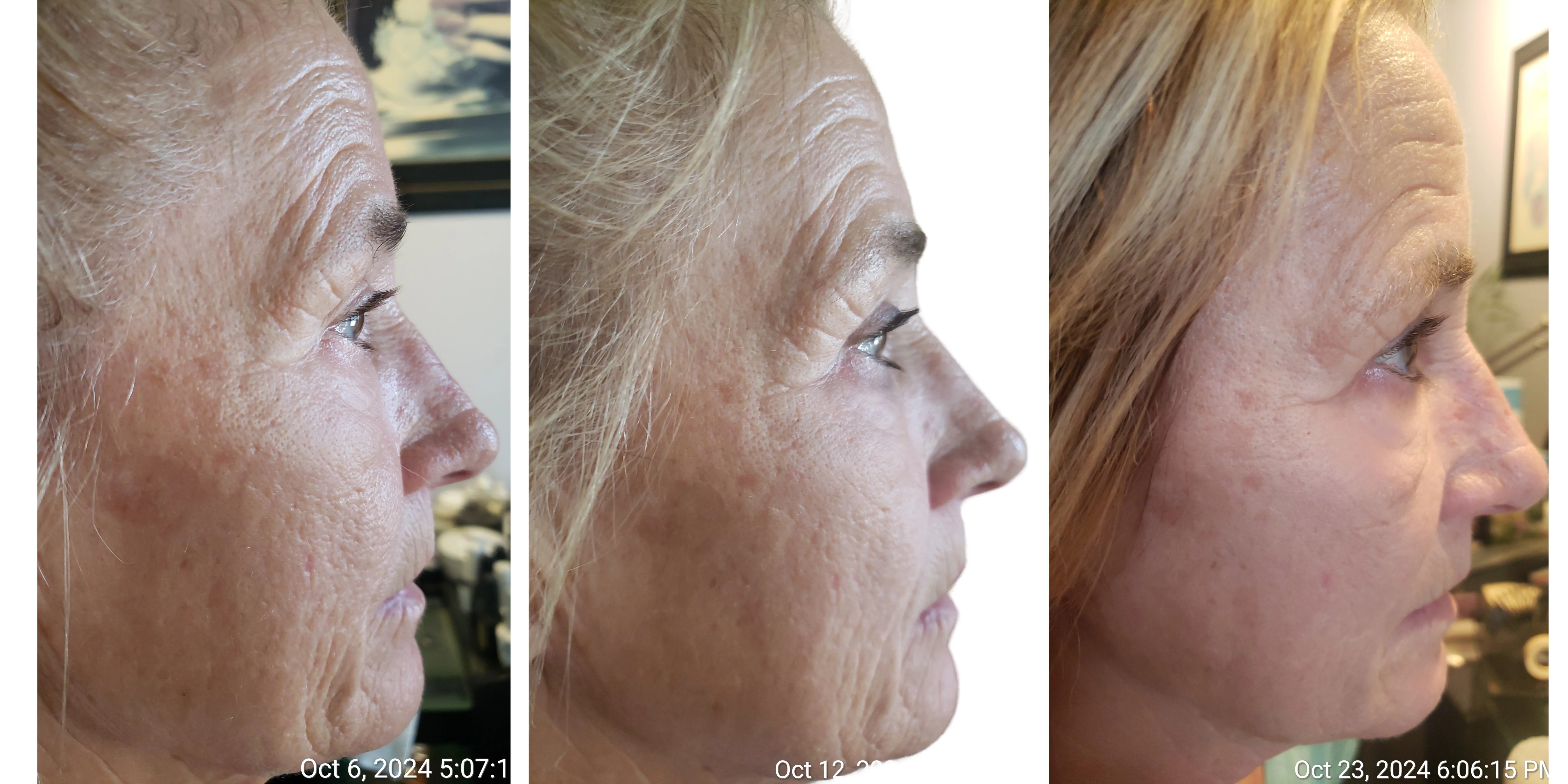 The Ultimate Anti-Aging Skincare Serum Guide: Japanese Stem Cell Technology & Collagen Production