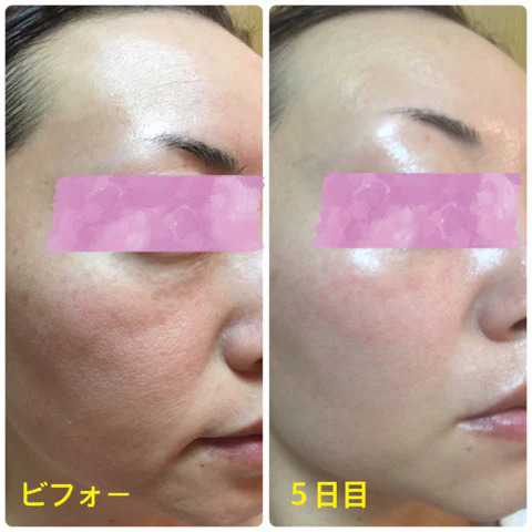 The Ultimate Anti-Aging Skincare Serum Guide: Japanese Stem Cell Technology & Collagen Production