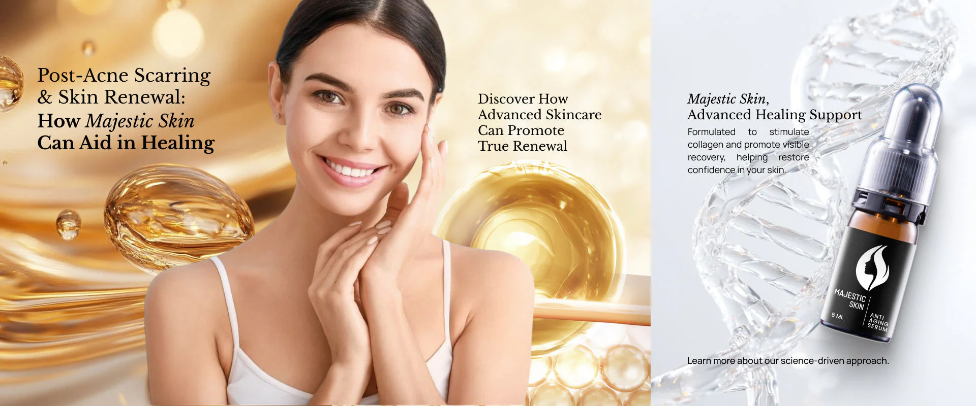 Post-Acne Scarring & Skin Renewal: How Majestic Skin Can Aid in Healing