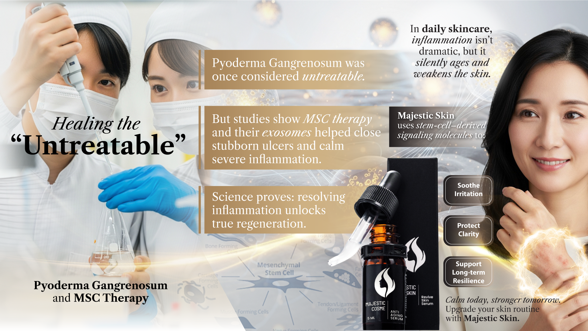 Healing the “Untreatable”: Pyoderma Gangrenosum and MSC Therapy