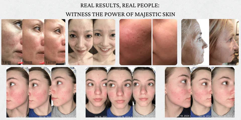 Introducing the Next Generation of Majestic Skin Serum