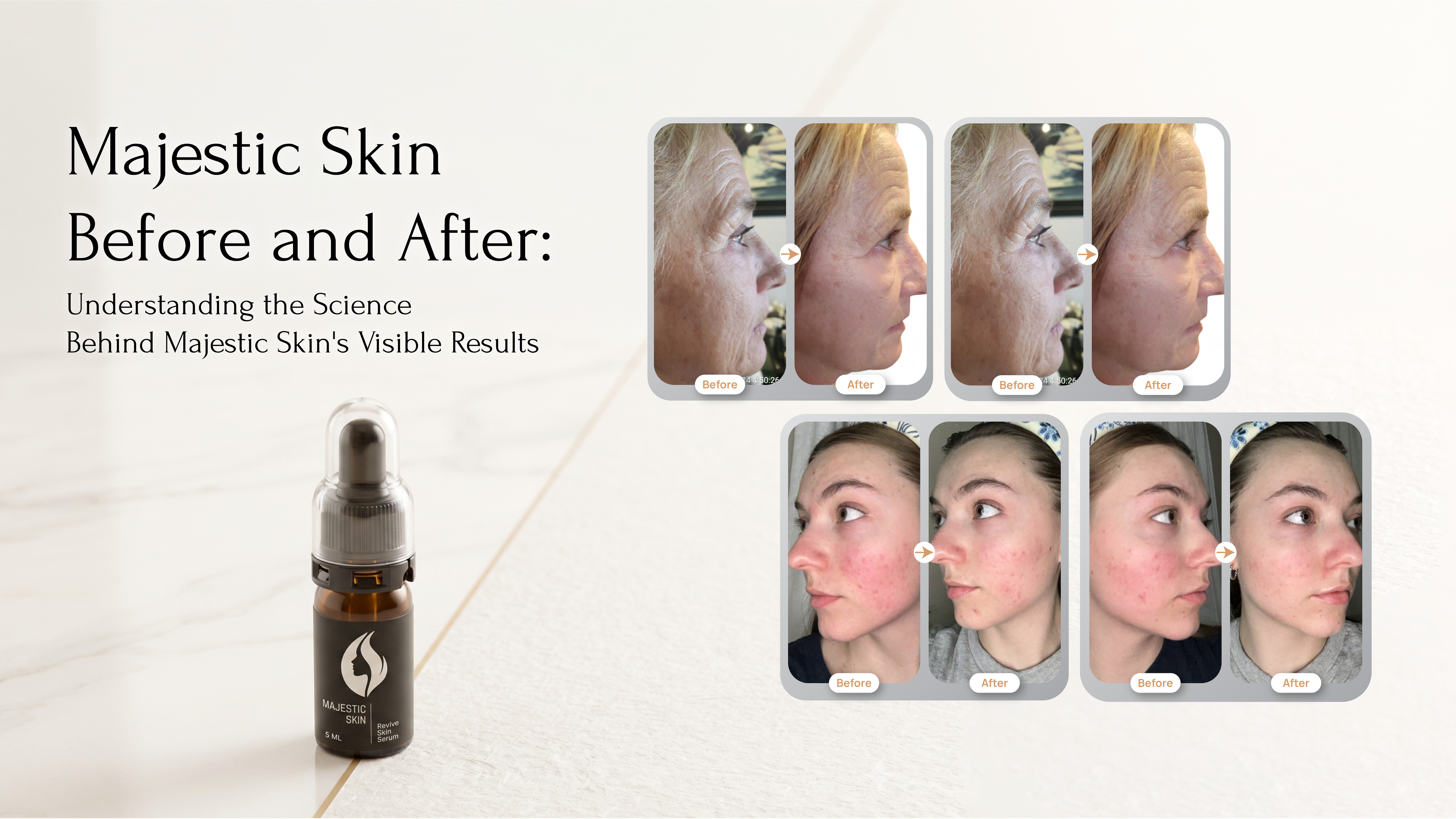 Majestic Skin Before and After: See Real Transformations