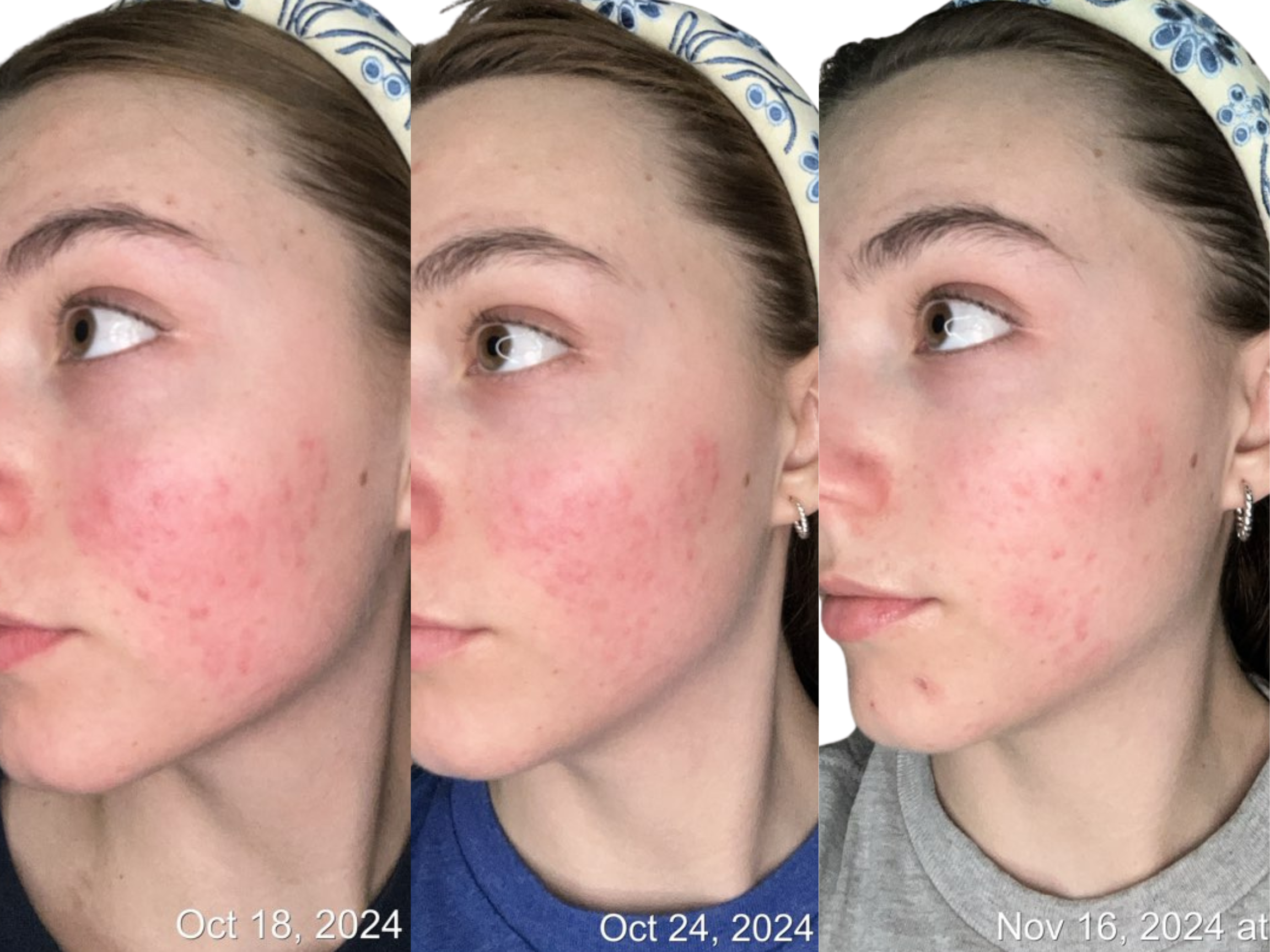 Why Top Aesthetic Doctors Globally Recommend Majestic Cosme’s Biotechnology Range