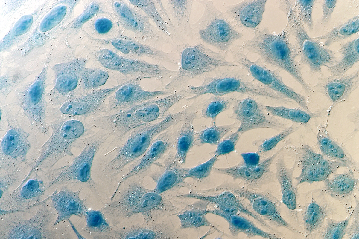 The immortality of Henrietta Lacks How her cells changed