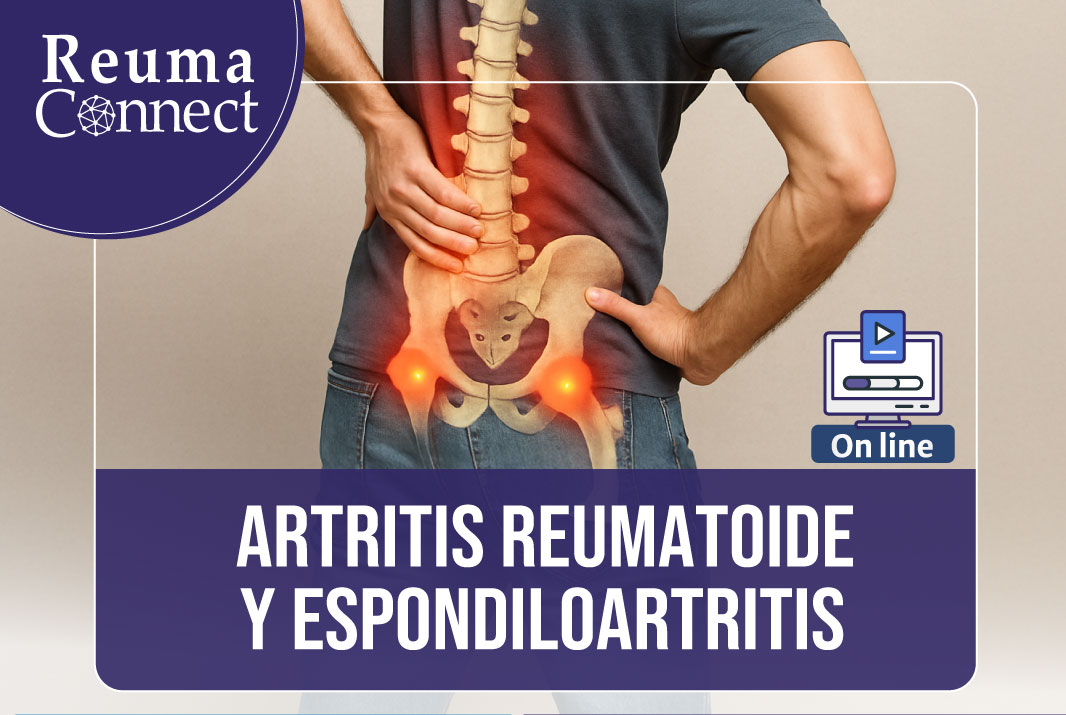 Imagen de portada para Artritis reumatoide y Espondiloartritis.