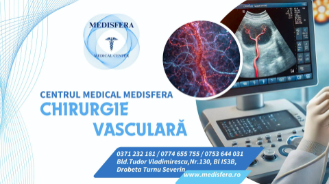 Imagine pentru Chirurgie Vasculara