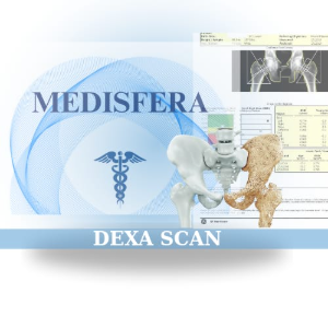 Imagine pentru Osteodensitometrie Dual-Energy X-Ray